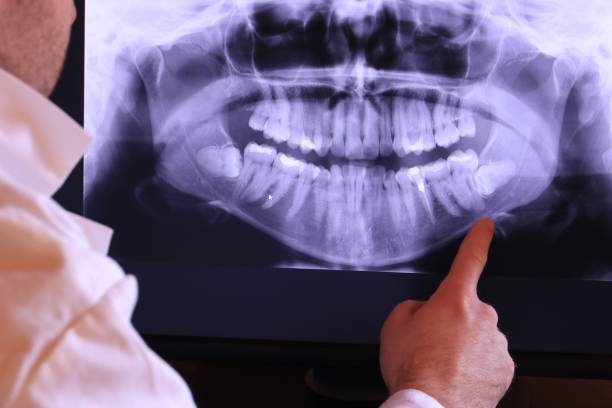 Best Broken or Cracked Tooth Emergency Dentist in Lynwood, CA