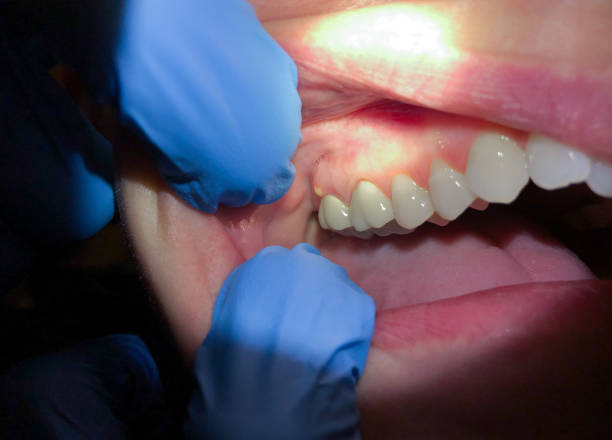 Best Emergency Dentist for Knocked-Out Tooth in Lynwood, CA